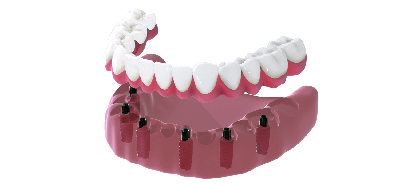 Картинка 3D модели